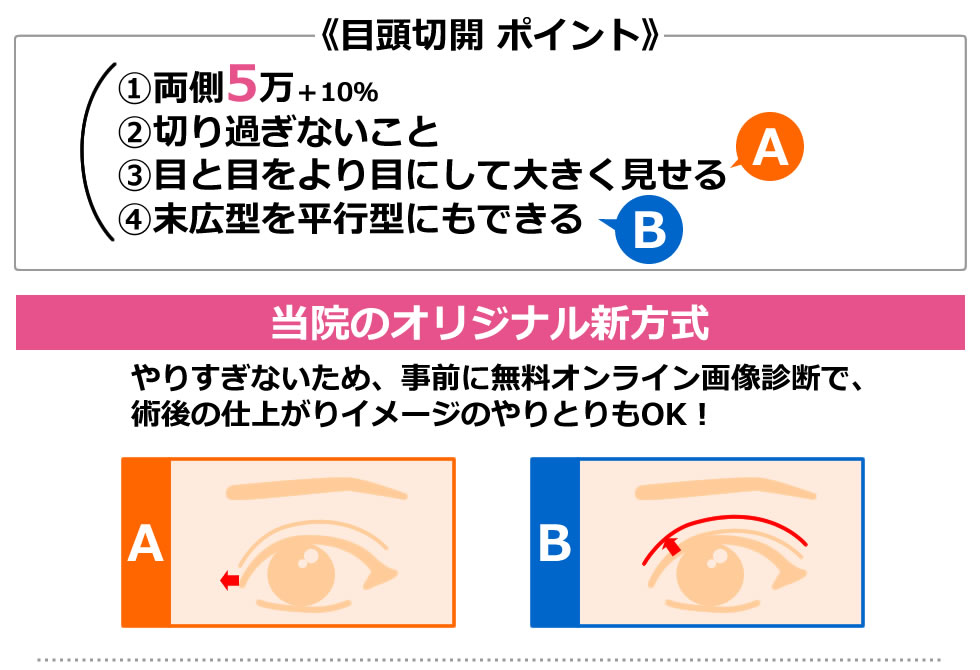 目頭切開