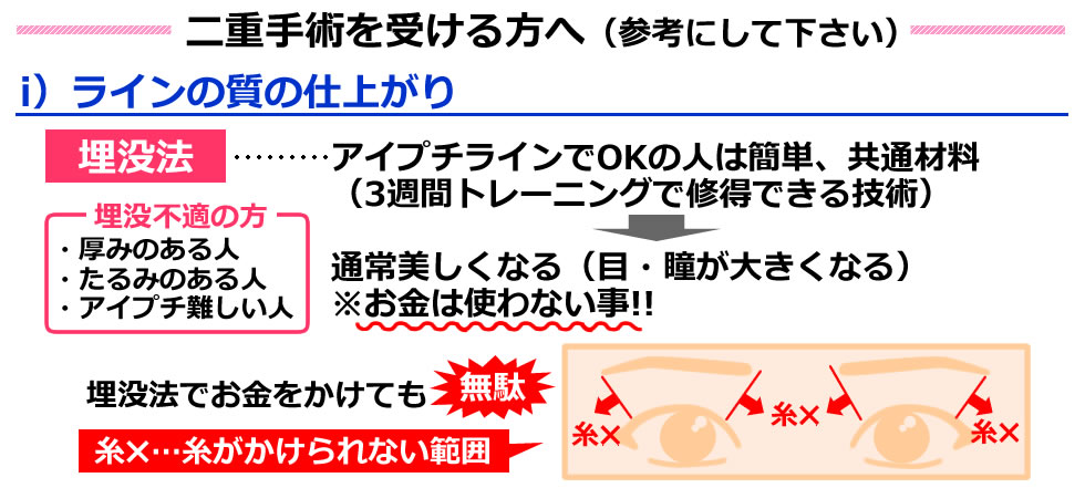 二重手術を受ける方へ