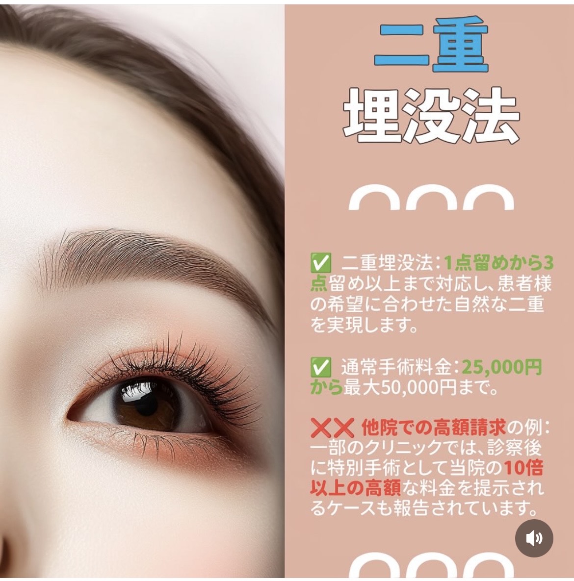二重埋没法