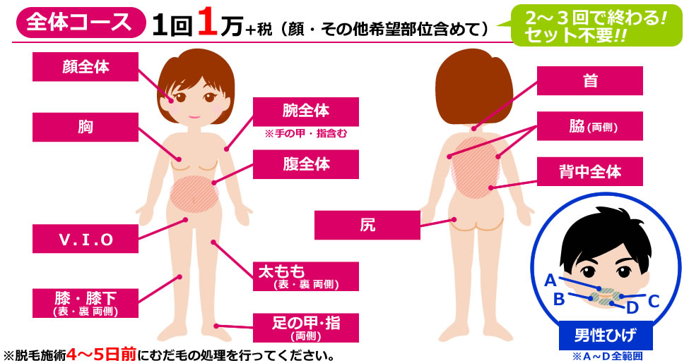 各部位の脱毛料金