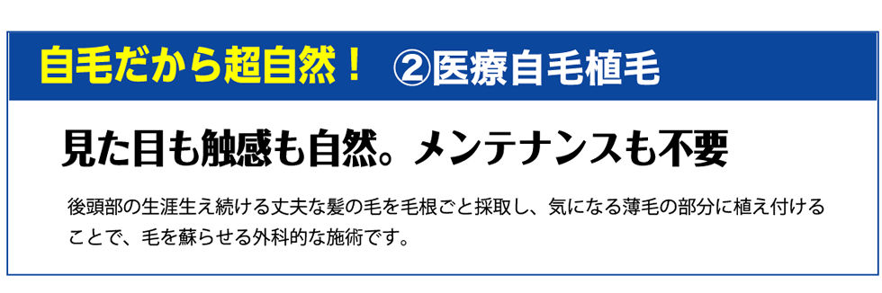 自毛だから超自然!②医療自毛植毛 見た目も触感も自然。メンテナンスも不要 後頭部の生涯生え続ける丈夫な髪の毛を毛根ごと採取し、気になる薄毛の部分に植え付けることで、毛を蘇らせる外科的な施術です。