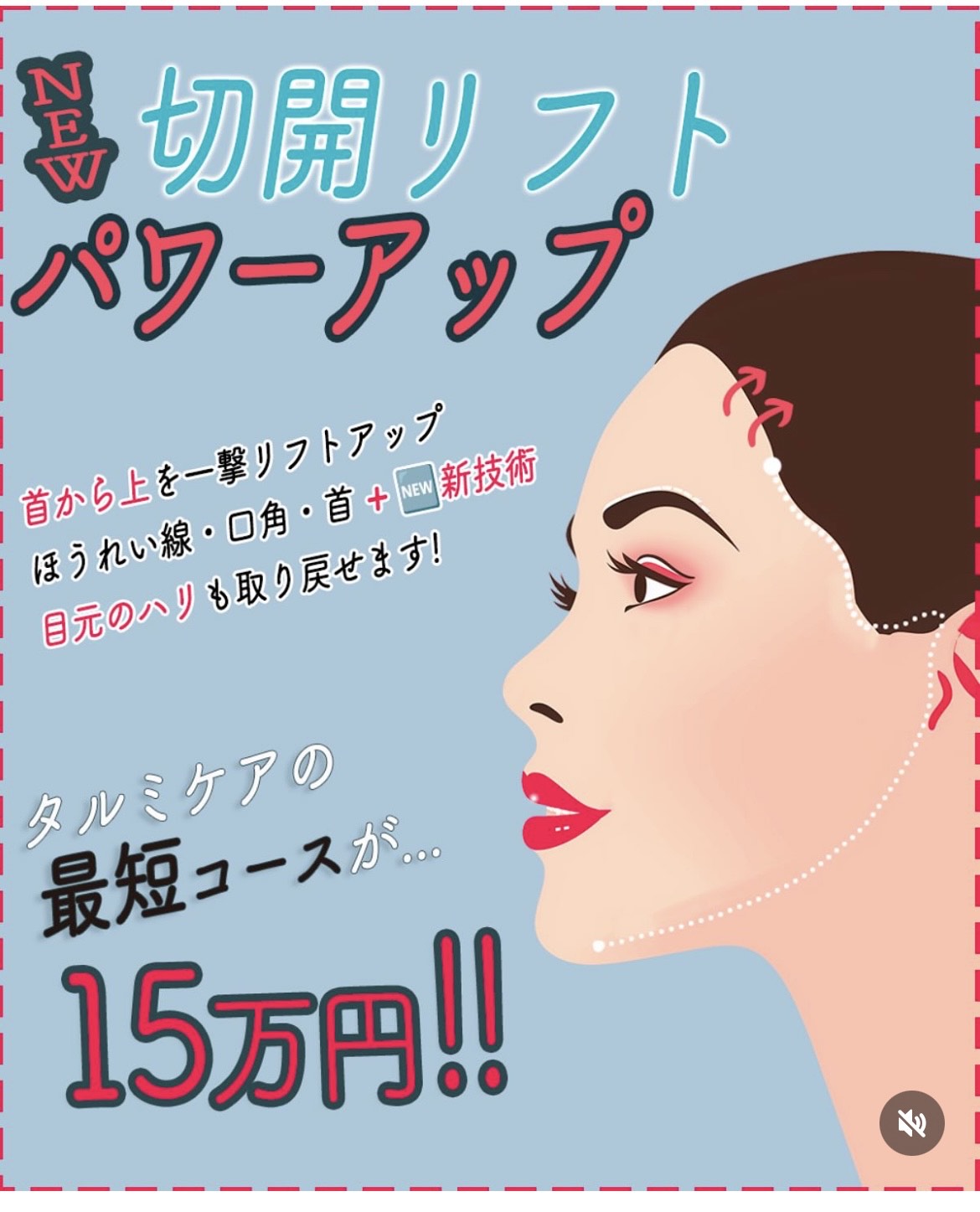切開リフト　パワーアップ