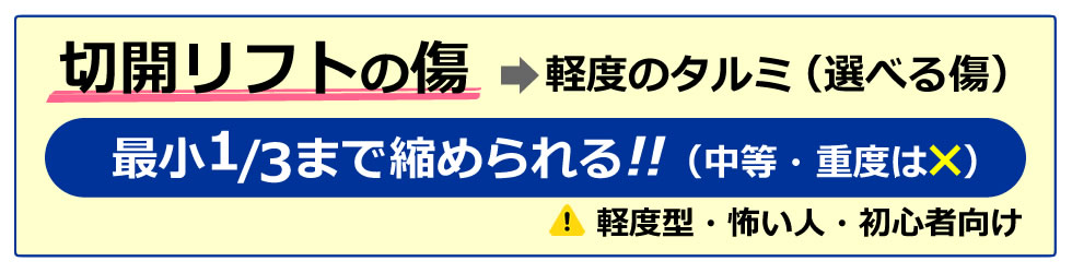 切開リフトのは最小1/3まで縮められる！！