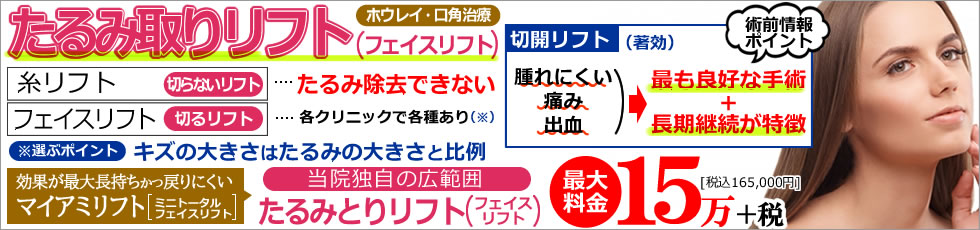 フェイスリフト　マイアミリフト