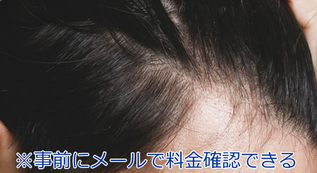 薄毛・ハゲ治療